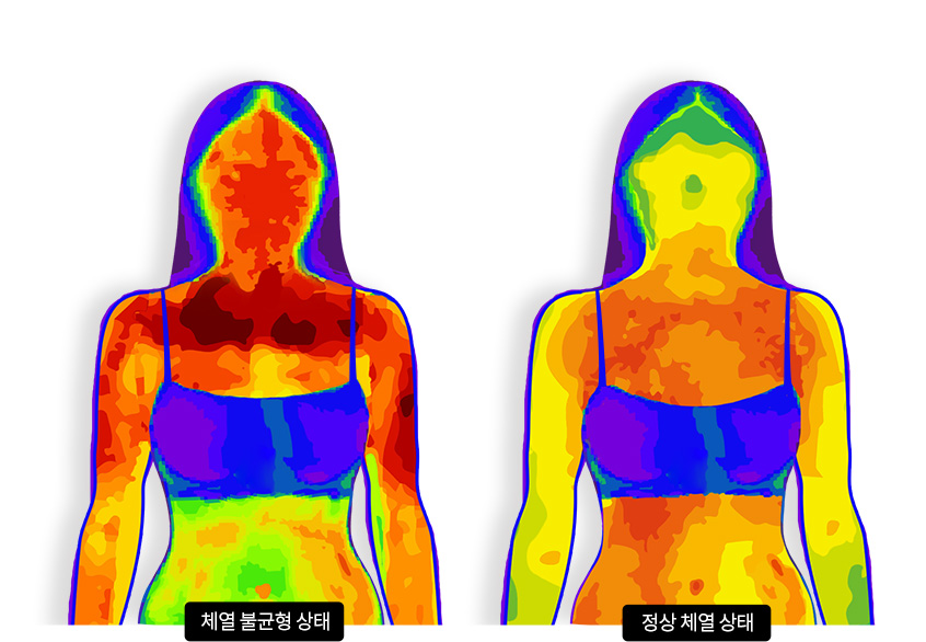 체열 불균형 상태 vs 정상 체열 상태