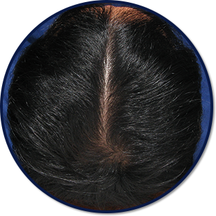 양모단계 머리사진