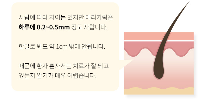 탈모 환자가 가장 크게 느끼는 스트레스는 탈모 그 자체보다도 ‘치료가 안 되면 어쩌지’ 하는 두려움일 것입니다. 사람에 따라 차이는 있지만 머리카락은 하루에 0.2~0.5mm 정도 자랍니다. 한달로 봐도 약 1cm 밖에 안됩니다. 때문에 환자 혼자서는 치료가 잘 되고 있는지 알기가 매우 어렵습니다.