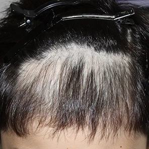 발머스한의원 노원점 치료 전