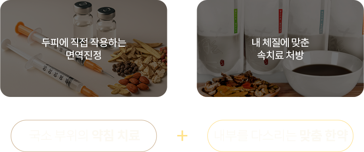 약침과 맞춤 한약 치료