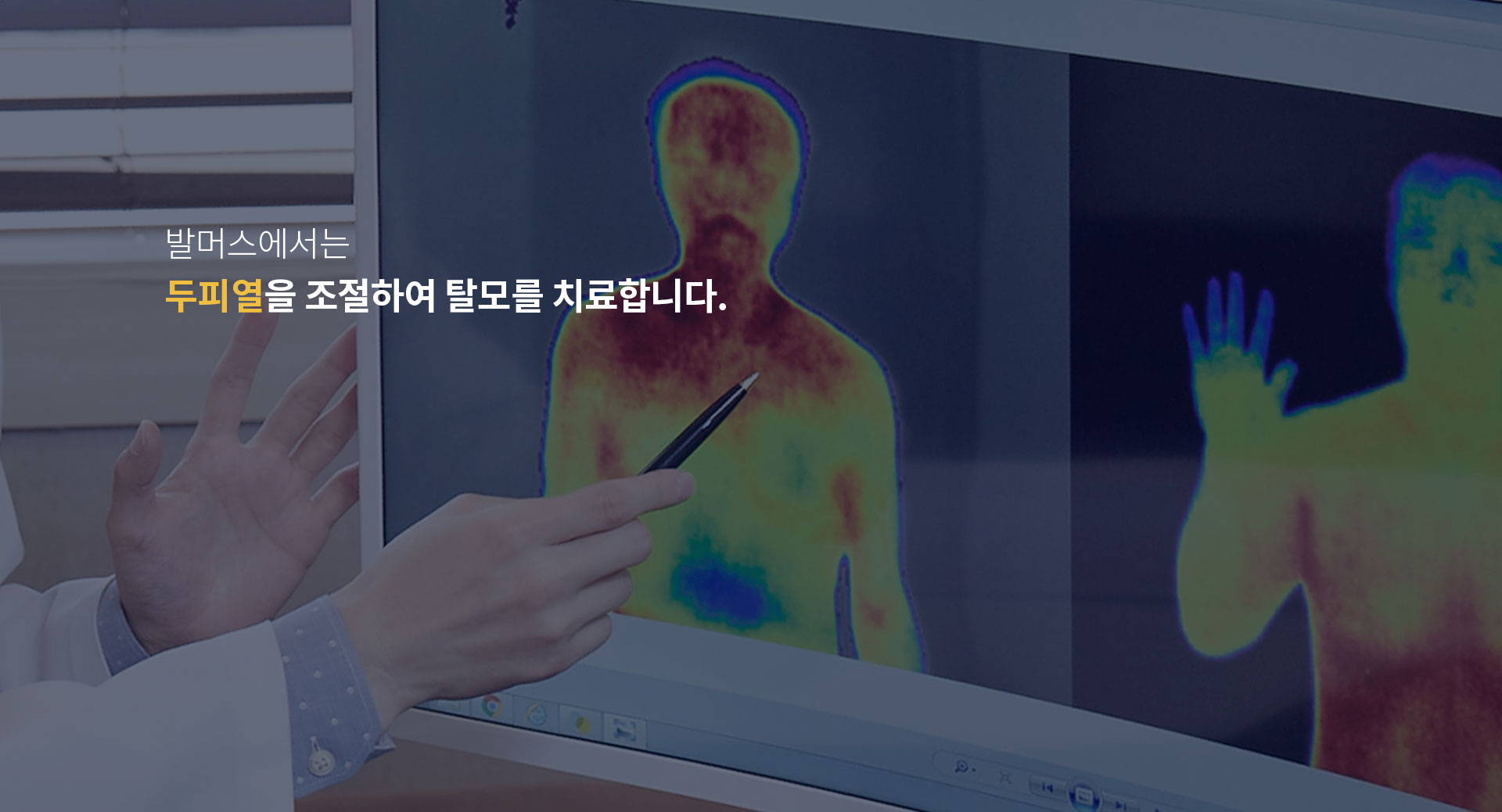 발머스에서는 두피열을 조절하여 탈모를 치료합니다.