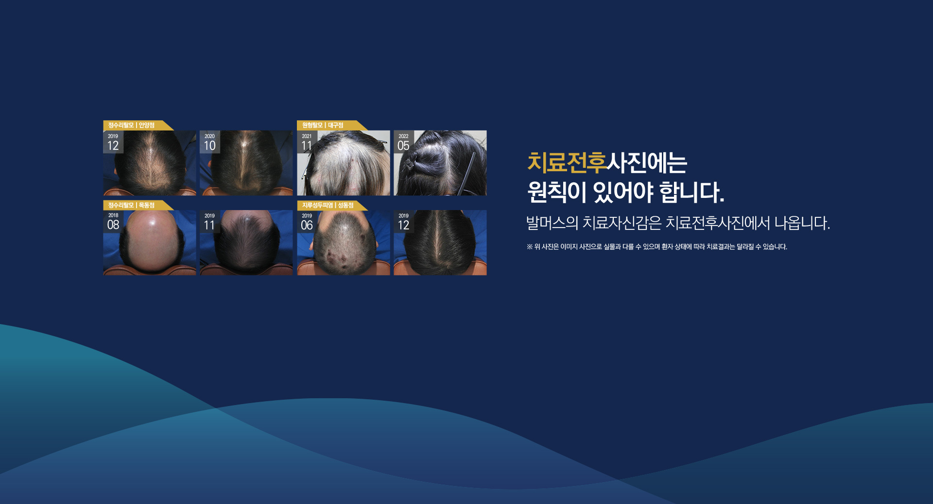 치료전후사진에는 원칙이 있어야 합니다.